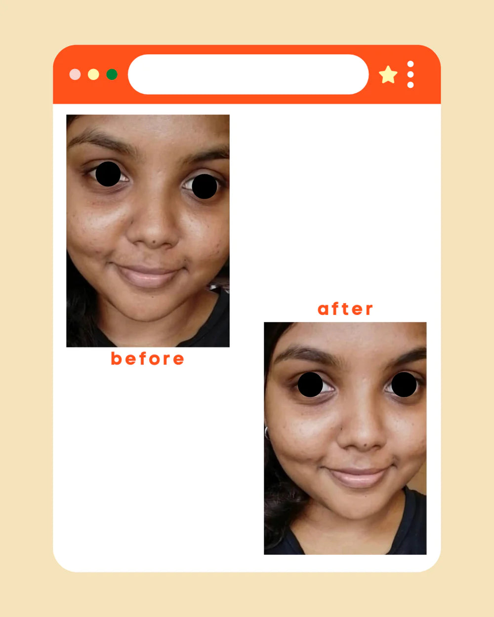 Alluskin Porefining Salicylic Acid Clay Mask (5g)