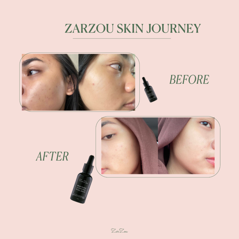 BHS Zarzou Brightening &amp; Hydrating Facial Serum (30ml)